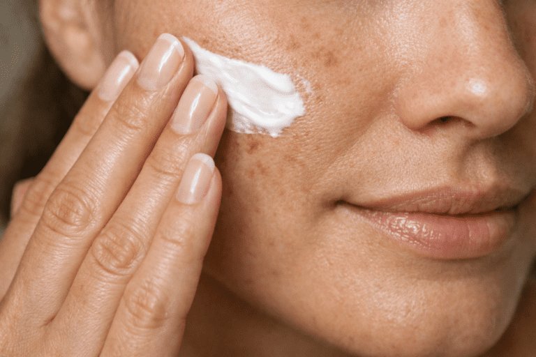 melhores cremes clareadores de manchas no rosto